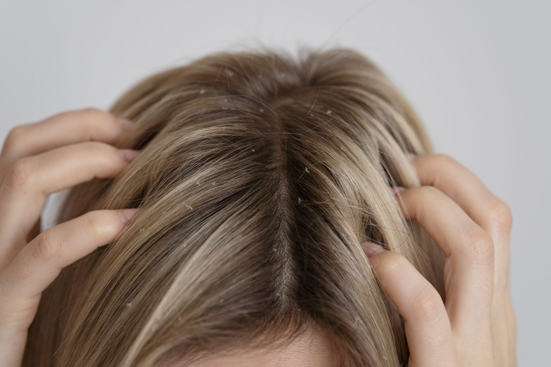 forfora capelli